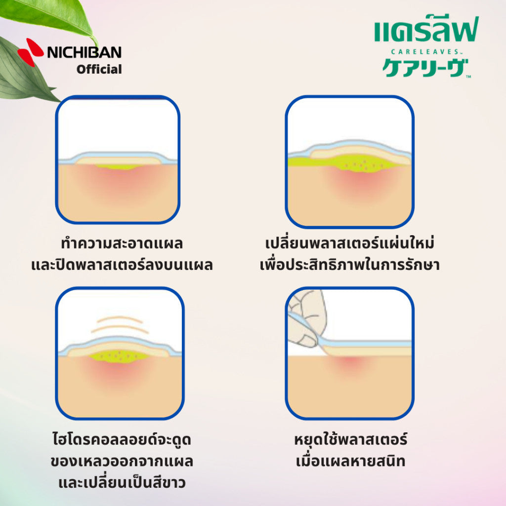 NICHIBAN Careleaves Hydrocolloid Plaster (M Size) ฟิล์มปิดแผลถลอก คีลอยด์ พลาสเตอร์กันน้ำ ปิดแผลสด (1 กล่อง มี 20 ชิ้น)