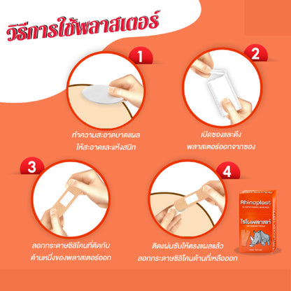 Rhinoplast Rhinoplastic Plasters (100 Plaster/Box)